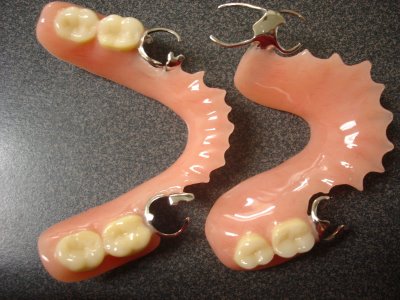 ảnh tháo lắp nhựa cứng bán phần